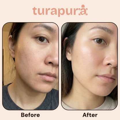 Turapura PDRN Glow Cream